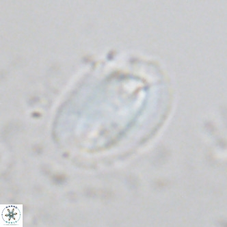 Helicosphaera burkei VR 07818