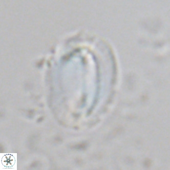 Helicosphaera burkei VR 07819