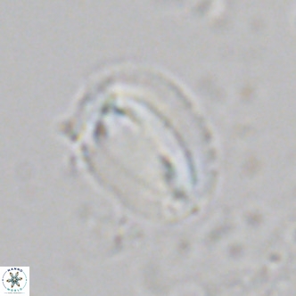 Helicosphaera burkei VR 07820