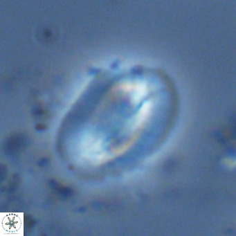 Helicosphaera burkei VR 07821