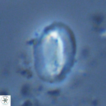 Helicosphaera burkei VR 07822