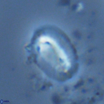 Helicosphaera burkei VR 07823
