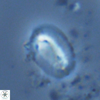 Helicosphaera burkei VR 07823