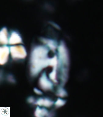 Helicosphaera bipuncta 457