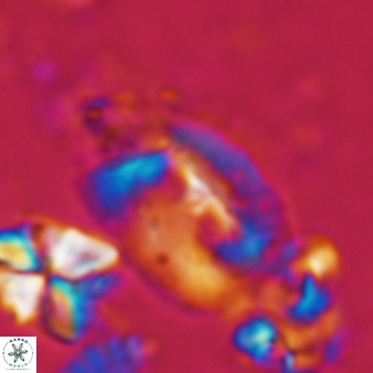 Helicosphaera bipuncta 459