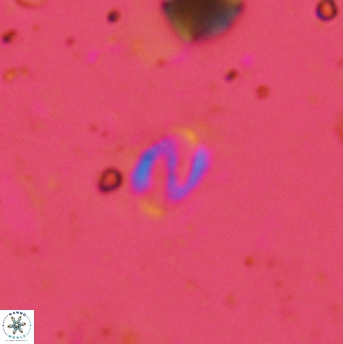 Helicosphaera bowmanii 2403