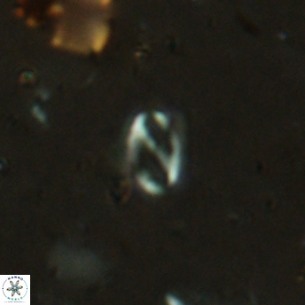 Helicosphaera bowmanii 2405