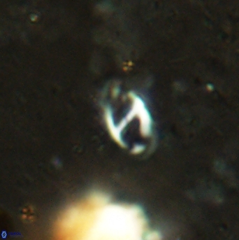 Helicosphaera africanus 2386