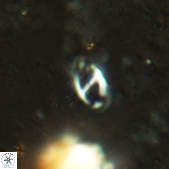 Helicosphaera africanus 2386