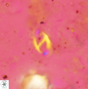 Helicosphaera africanus 2387
