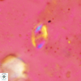 Helicosphaera bowmanii 2388