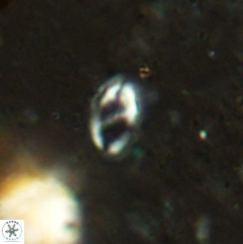 Helicosphaera bowmanii 2390