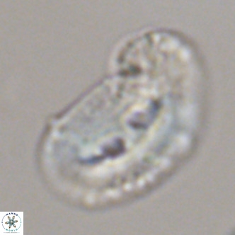 Helicosphaera bownii VR 09307