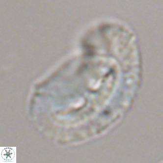 Helicosphaera bownii VR 09308