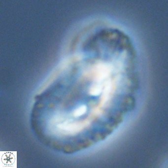 Helicosphaera bownii VR 09317