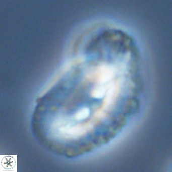 Helicosphaera bownii VR 09318