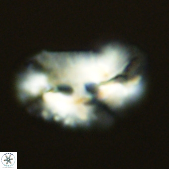 Helicosphaera bownii VR 09320