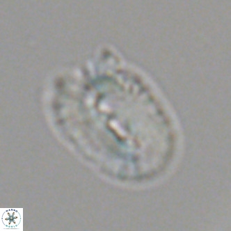 Helicosphaera bownii VR 09512