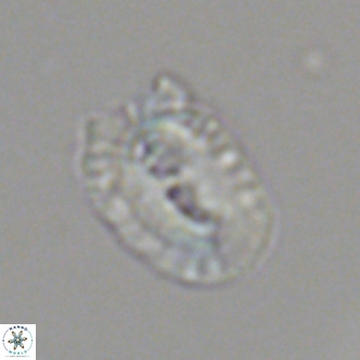 Helicosphaera bownii VR 09513