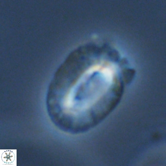 Helicosphaera bownii VR 09519