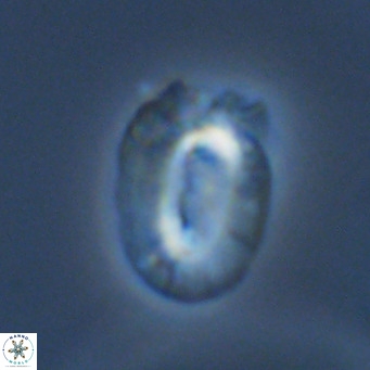 Helicosphaera bownii VR 09520