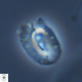 Helicosphaera bownii VR 09521