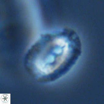 Helicosphaera bownii VR 09640