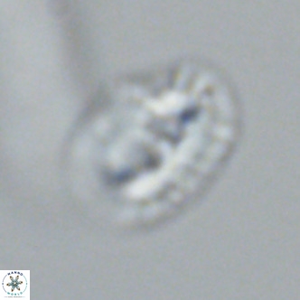 Helicosphaera bownii VR 09634