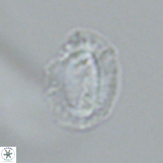 Helicosphaera bownii VR 09636