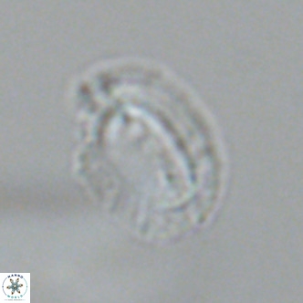 Helicosphaera bownii VR 09637