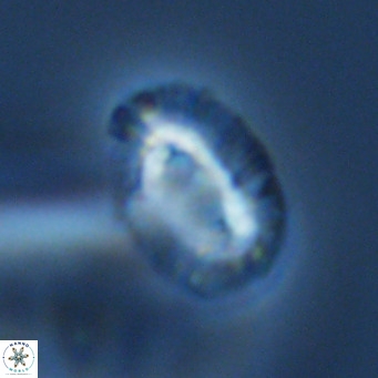 Helicosphaera bownii VR 09638