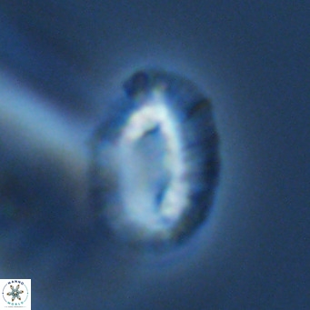 Helicosphaera bownii VR 09639
