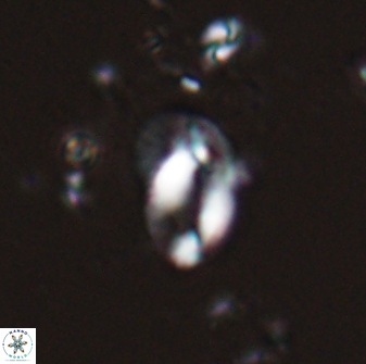 Helicosphaera californiana 27571