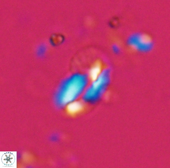Helicosphaera californiana 27573