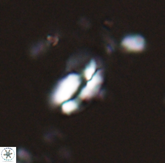 Helicosphaera californiana 27574