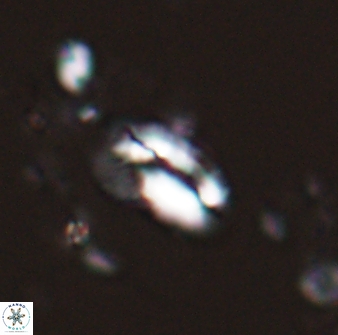 Helicosphaera californiana 27575