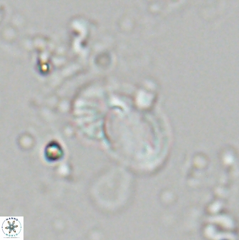 Helicosphaera californiana 27577