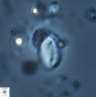 Helicosphaera californiana 27579