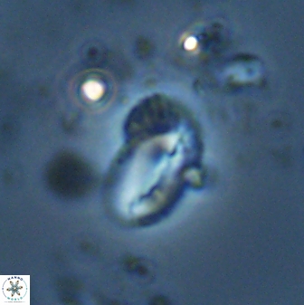 Helicosphaera californiana 27580