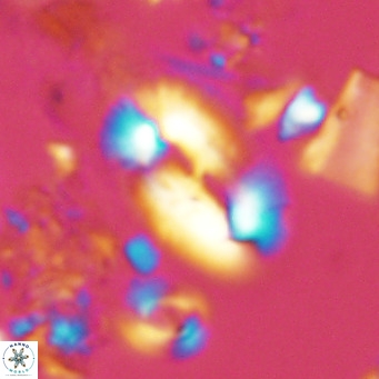 Helicosphaera carteri carteri VR 03765