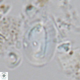Helicosphaera carteri carteri VR 03770