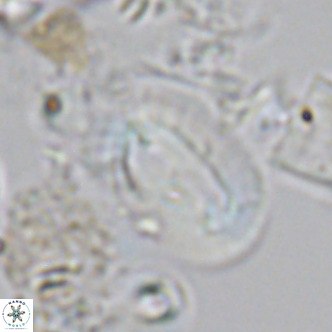 Helicosphaera carteri carteri VR 03771