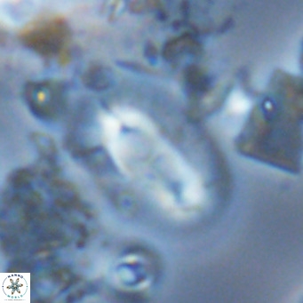 Helicosphaera carteri carteri VR 03772
