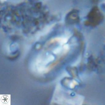 Helicosphaera carteri carteri VR 03775