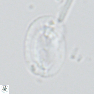 Helicosphaera carteri carteri VR 03864