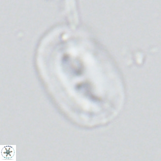 Helicosphaera carteri carteri VR 03865