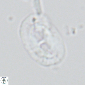 Helicosphaera carteri carteri VR 03866