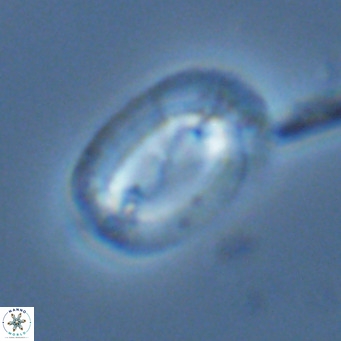 Helicosphaera carteri carteri VR 03869