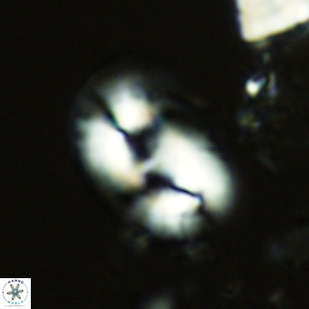 Helicosphaera carteri carteri VR 04566