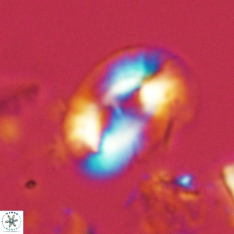 Helicosphaera carteri carteri VR 04568